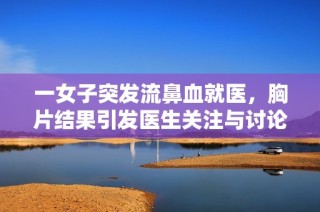 一女子突发流鼻血就医，胸片结果引发医生关注与讨论
